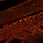 Drosophila body wall muscle