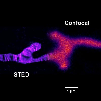 STED vs Confocal Mito